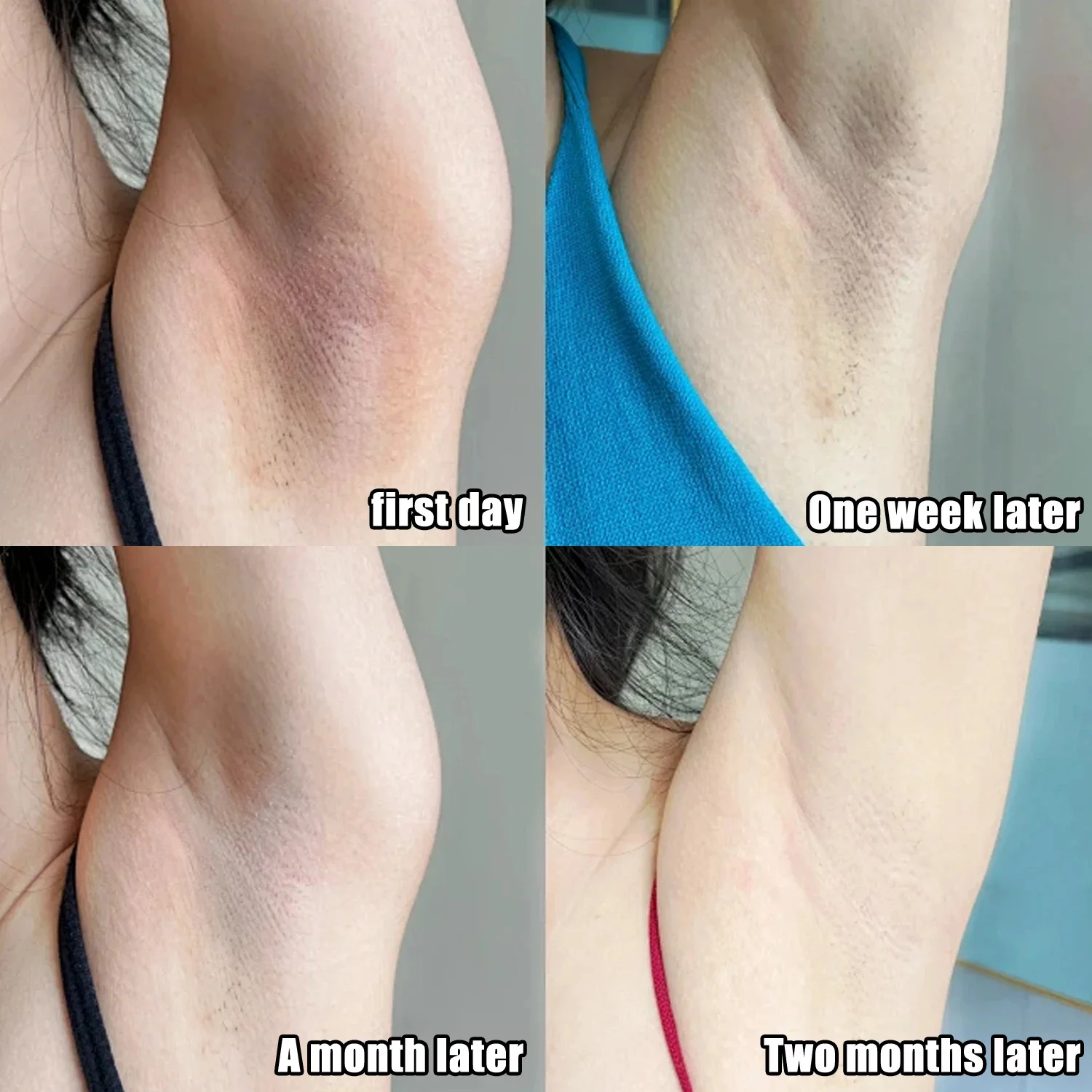Krim Pemutih Ketiak Kolagen un - Skincare Whitening ulasan dan harga