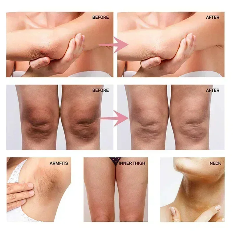Krim Pemutih Ketiak Kolagen un - Skincare Whitening ulasan dan harga