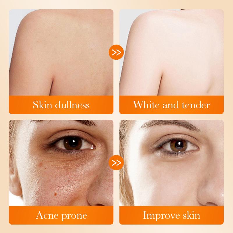 1 Buah SADOER Sabun Wajah Asam - Kojic Acid Soap ulasan dan harga