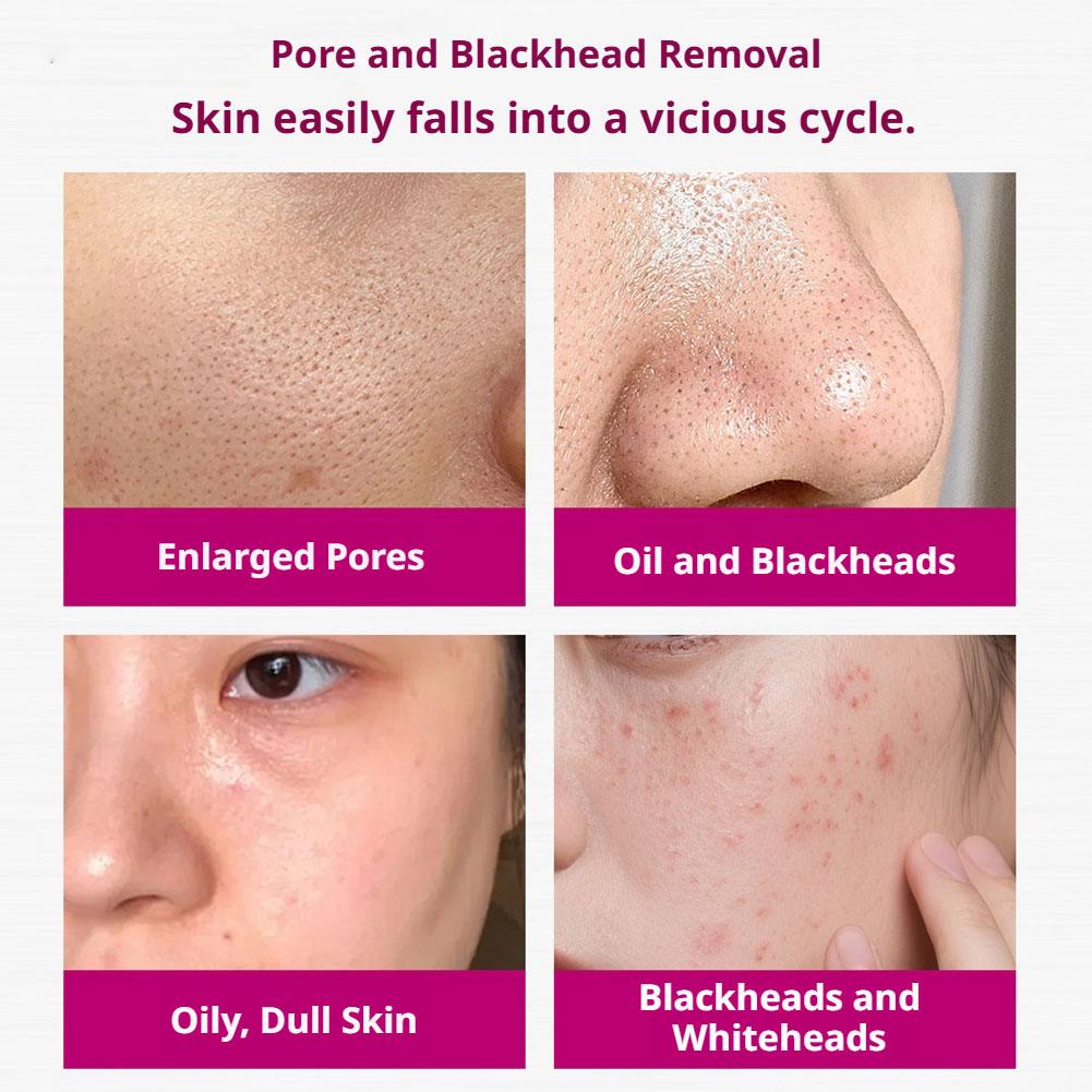 Serum Asam Salisilat Mengecilk - Skincare Skintific ulasan dan harga