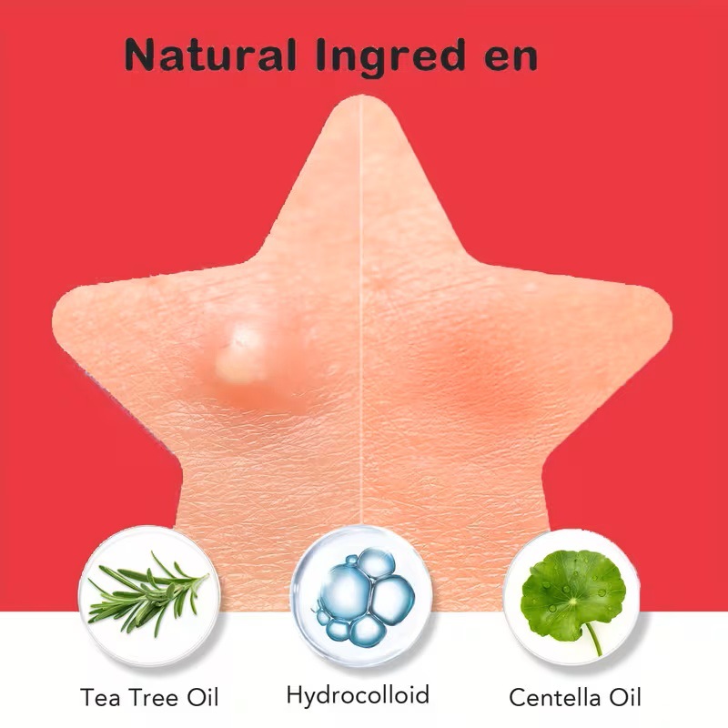 200/400 Buah Tambalan Jerawat  - Skincare Whitening ulasan dan harga